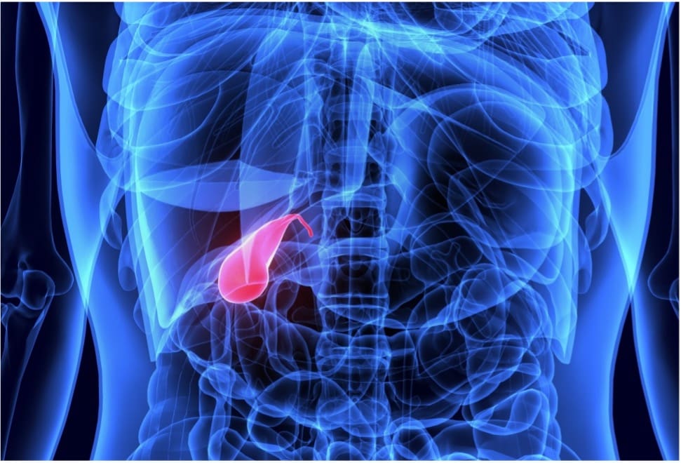 Όλα όσα πρέπει να γνωρίζουμε για τη χολολιθίαση ή “πέτρες στη χολή”