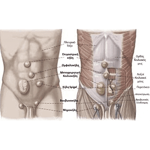 Όλα όσα χρειάζεται να γνωρίζουμε για τις κήλες